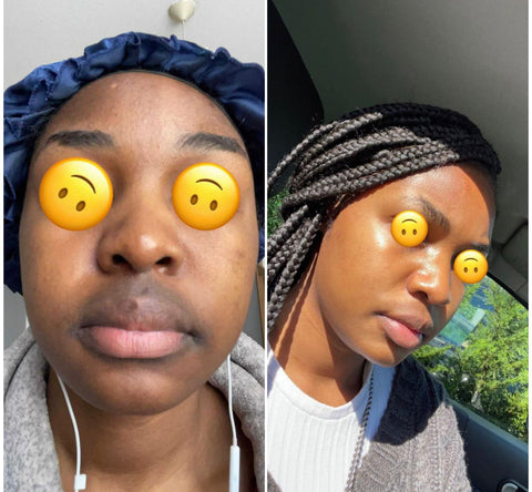 Anti-Hyperpigmentation Face Cream