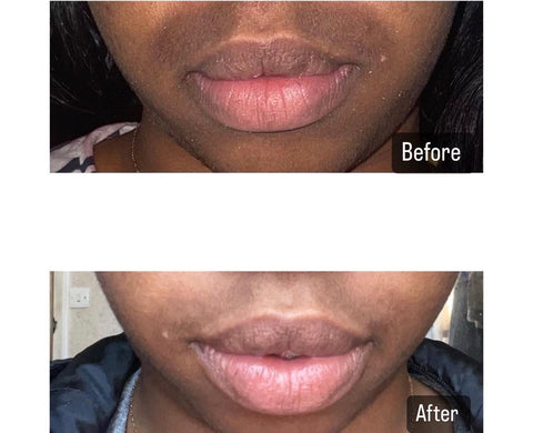 Anti-Hyperpigmentation Face Cream